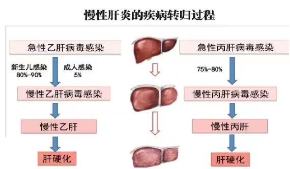 【健康科普】世界肝炎日——堅(jiān)持早預(yù)防，加強(qiáng)檢測(cè)發(fā)現(xiàn)，規(guī)范抗病毒治療